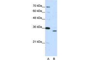 Western Blotting (WB) image for anti-Proteasome Subunit alpha Type 1 (PSMA1) antibody (ABIN2462129) (PSMA1 antibody)