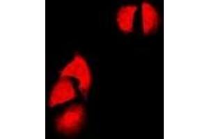 Immunofluorescent analysis of Cyclin D2 staining in SW480 cells. (Cyclin D2 antibody)