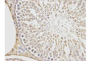 Immunohistochemistry (IHC) image for anti-Placenta Growth Factor (PGF) antibody (ABIN1874109) (PLGF antibody)
