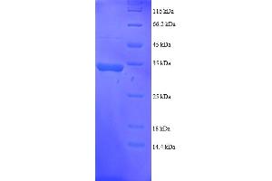 SDS-PAGE (SDS) image for Growth Arrest and DNA-Damage-Inducible, alpha (GADD45A) (AA 1-165), (full length) protein (His-SUMO Tag) (ABIN5709547) (GADD45A Protein (AA 1-165, full length) (His-SUMO Tag))