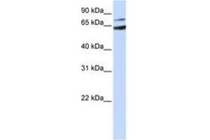 Image no. 1 for anti-Frizzled Family Receptor 8 (FZD8) (AA 144-193) antibody (ABIN6743056) (FZD8 antibody  (AA 144-193))