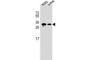 Western blot analysis of HOXA6 / HOX1B Antibody (Center) in K562, Jurkat cell line lysates (35ug/lane). (HOXA6 antibody  (Middle Region))