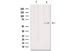 Western blot analysis of extracts from Hela, using SLC24A3 Antibody. (SLC24A3 antibody  (Internal Region))