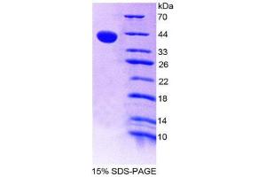 SDS-PAGE (SDS) image for Tachykinin 3 (TAC3) (AA 29-101) protein (His tag,GST tag) (ABIN2123372)