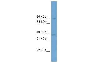 WB Suggested Anti-GTF2A1 Antibody Titration: 0. (GTF2A1 antibody  (Middle Region))
