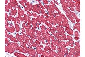 Immunohistochemical analysis of paraffin-embedded human Heart tissues using MYL3 mouse mAb. (MYL3/CMLC1 antibody)