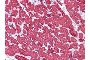 Immunohistochemical analysis of paraffin-embedded human Heart tissues using MYL3 mouse mAb.