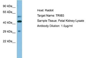 Host: Rabbit Target Name: TRIB3 Sample Type: Fetal Kidney lysates Antibody Dilution: 1. (TRIB3 antibody  (N-Term))