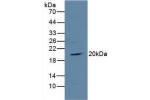 Detection of TIRAP in Rat Heart Tissue using Polyclonal Antibody to Toll Interleukin 1 Receptor Domain Containing Adaptor Protein (TIRAP) (TIRAP antibody  (AA 1-221))