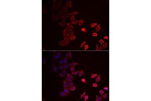 Immunofluorescence analysis of MCF7 cells using P2RX4 antibody (ABIN6132449, ABIN6145115, ABIN6145116 and ABIN6222387). (P2RX4 antibody  (AA 55-338))