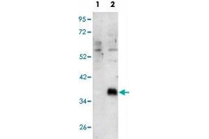 Western blot analysis of DOK4 (arrow) using DOK4 polyclonal antibody . (DOK4 antibody  (C-Term))