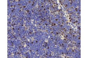 Immunohistochemistry analysis of paraffin-embedded mouse thymus using RACGAP1 Polyclonal Antibody at dilution of 1:400. (RACGAP1 antibody)