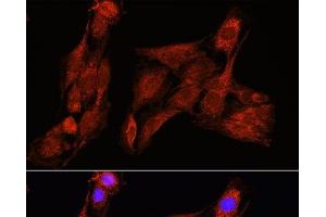 Immunofluorescence analysis of C6 cells using PSAT1 Polyclonal Antibody at dilution of 1:100 (40x lens). (PSAT1 antibody)