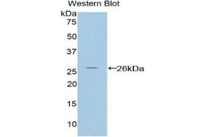 Western Blotting (WB) image for anti-Protein Interacting With Protein Kinase C, alpha 1 (PICK1) (AA 24-229) antibody (ABIN1860209) (PICK1 antibody  (AA 24-229))