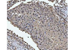 IHC analysis of HOXC4 using anti-HOXC4 antibody (ABIN7603059). (HOXC4 antibody  (Middle Region))
