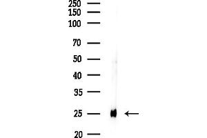 anti-Ribosomal Protein L10a (RPL10A) (C-Term) antibody