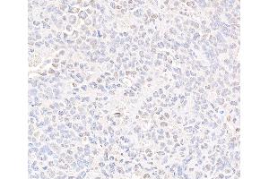 Immunohistochemistry (IHC) image for anti-Structural Maintenance of Chromosomes 3 (SMC3) (C-Term) antibody (ABIN7453572) (SMC3 antibody  (C-Term))