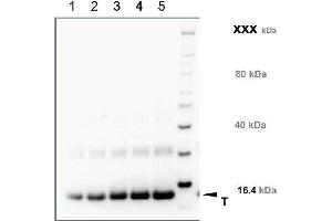 Western Blotting (WB) image for anti-Transmembrane Protein 37 (TMEM37) (N-Term) antibody (ABIN1720796) (TMEM37 antibody  (N-Term))