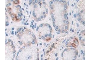 Immunohistochemistry (IHC) image for anti-phosphorylase, Glycogen, Brain (GPBB) (AA 477-731) antibody (ABIN7439942)