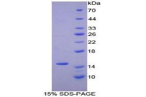 SDS-PAGE analysis of Human Numb Homolog Protein. (NUMB Protein)