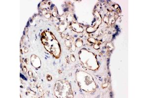Anti-CD31 antibody, IHC(P): Human Placenta Tissue (CD31 antibody  (C-Term))