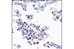 ARHGDIB Antibody (C-term) (ABIN657665 and ABIN2846658) immunohistochemistry analysis in formalin fixed and paraffin embedded human lung tissue followed by peroxidase conjugation of the secondary antibody and DAB staining. (ARHGDIB antibody  (C-Term))