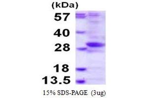 SDS-PAGE (SDS) image for Phosphatase, Orphan 2 (PHOSPHO2) (AA 1-241) protein (His tag) (ABIN668005) (PHOSPHO2 Protein (AA 1-241) (His tag))
