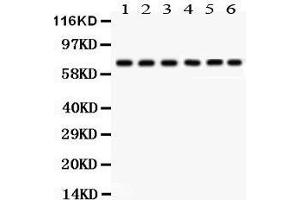 nti- PKC delta antibody, Western blotting All lanes: Anti PKC delta  at 0.