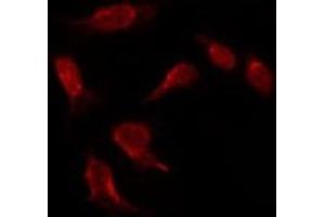 ABIN6275532 staining HepG2 by IF/ICC. (NIM1 antibody  (C-Term))