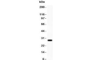 Western blot testing of Amyloid beta antibody and recombinant human protein (0.