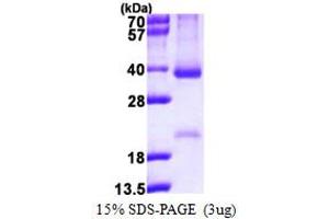 SDS-PAGE (SDS) image for Cyclin D2 (CCND2) (AA 1-289) protein (His tag) (ABIN667637) (Cyclin D2 Protein (CCND2) (AA 1-289) (His tag))