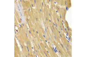 Immunohistochemistry of paraffin-embedded mouse heart using  antibody (ABIN3021755, ABIN3021756, ABIN3021757 and ABIN6215776) at dilution of 1:100 (40x lens). (Adenylate Kinase 1 antibody  (AA 1-194))