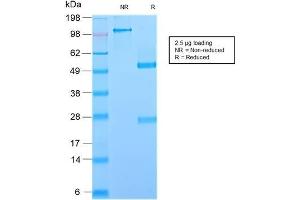 SDS-PAGE Analysis Purified GP2 Recombinant Rabbit Monoclonal Antibody (GP2/2569R). (Recombinant GP2 antibody  (AA 35-179))