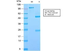 SDS-PAGE Analysis Purified GP2 Recombinant Rabbit Monoclonal Antibody (GP2/2569R). (Recombinant GP2 antibody  (AA 35-179))