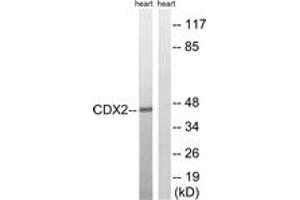 Western blot analysis of extracts from rat heart, using CDX2 (Ab-283) Antibody. (CDX2 antibody  (AA 249-298))