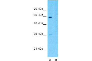 Western Blotting (WB) image for anti-SWI/SNF Related, Matrix Associated, Actin Dependent Regulator of Chromatin, Subfamily D, Member 3 (SMARCD3) (N-Term) antibody (ABIN2776387)
