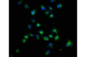 Immunofluorescence staining of Hela cells with ABIN7165221 at 1:22, counter-stained with DAPI. (CRB1 antibody  (AA 20-200))