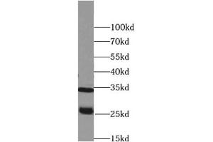 Western blot analysis of Raji cells subjected to SDS-PAGE, using PRSS2 antibody (1/500 dilution).