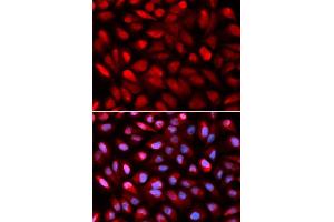 Immunofluorescence (IF) image for anti-Poly(rC) Binding Protein 2 (PCBP2) (AA 1-130) antibody (ABIN6219620) (PCBP2 antibody  (AA 1-130))