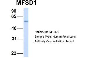 Host:  Rabbit  Target Name:  MFSD1  Sample Type:  Human Fetal Lung  Antibody Dilution:  1. (MFSD1 antibody  (Middle Region))