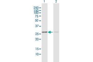 Western Blot analysis of ANP32B expression in transfected 293T cell line by ANP32B MaxPab polyclonal antibody. (ANP32B antibody  (AA 1-251))
