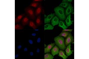 ABIN6259187 and ABIN6274307 staining Hela cells by IF/ICC.