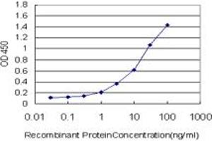 Detection limit for recombinant GST tagged ZNF263 is approximately 0. (ZNF263 antibody  (AA 201-298))