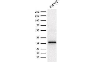Western blot Analysis of human Kidney lysate using Adiponectin Mouse Monoclonal Antibody (ADPN/1370).
