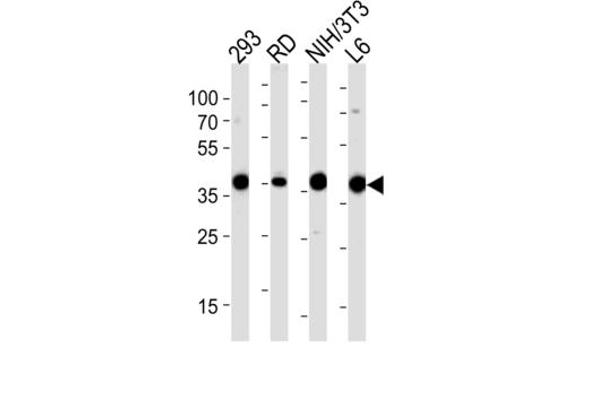 Aldolase antibody
