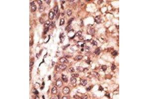 Image no. 2 for anti-CAMP Responsive Element Binding Protein 3-Like 1 (CREB3L1) (AA 490-519), (C-Term) antibody (ABIN358719) (CREB3L1 antibody  (C-Term))