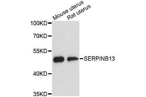 Western blot analysis of extracts of various cell lines, using SERPINB13 antibody. (SERPINB13 antibody  (AA 1-140))
