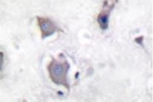 Image no. 2 for anti-Neurotrophic Tyrosine Kinase, Receptor, Type 2 (NTRK2) (pTyr705) antibody (ABIN318147) (TRKB antibody  (pTyr705))