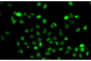 Immunofluorescence analysis of A549 cells using BCL6 Polyclonal Antibody (BCL6 antibody)