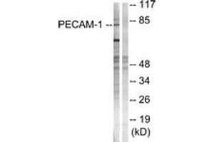 Western blot analysis of extracts from Jurkat cells, using PECAM-1 (Ab-713) Antibody. (CD31 antibody  (AA 686-735))